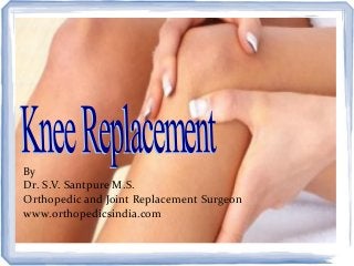 By
Dr. S.V. Santpure M.S.
Orthopedic and Joint Replacement Surgeon
www.orthopedicsindia.com
 