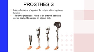 PROSTHESIS
 Is the substitution of a part of the body to achieve optimum
function .
 The term "prosthesis" refers to an external assistive
device applied to replace an absent limb.
 