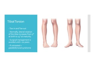 Tibial Normal Development Knee and Foot Deformities in pediatrics.pdf