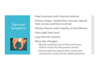 Mid Foot Internal Rotation Knee and Foot Deformities in pediatrics.pdf