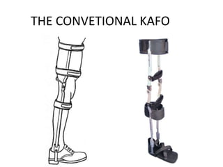 THE CONVETIONAL KAFO
 