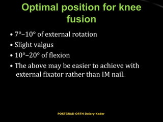 Optimal position for kneeOptimal position for knee
fusionfusion
•• 7°–10° of external rotation7°–10° of external rotation
•• Slight valgusSlight valgus
•• 10°–20° of flexion10°–20° of flexion
•• The above may be easier to achieve withThe above may be easier to achieve with
external fixator rather than IM nail.external fixator rather than IM nail.
POSTGRAD ORTH Deiary KaderPOSTGRAD ORTH Deiary Kader
 