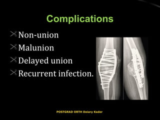 ComplicationsComplications
Non-unionNon-union
MalunionMalunion
Delayed unionDelayed union
Recurrent infection.Recurrent infection.
POSTGRAD ORTH Deiary KaderPOSTGRAD ORTH Deiary Kader
 