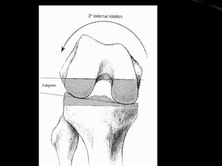 Knee arthroplasty for FRCS Orth course Newcastle