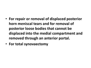 • For repair or removal of displaced posterior
horn meniscal tears and for removal of
posterior loose bodies that cannot be
displaced into the medial compartment and
removed through an anterior portal.
• For total synovaectomy
 