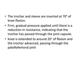 • The trochar and sleeve are inserted at 70° of
knee ﬂexion.
• Firm, gradual pressure applied until there is a
reduction in resistance, indicating that the
trochar has passed through the joint capsule.
• knee is extended to around 20° of ﬂexion and
the trochar advanced, passing through the
patellofemoral joint
 