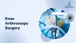 Knee
Arthroscopy
Surgery
 