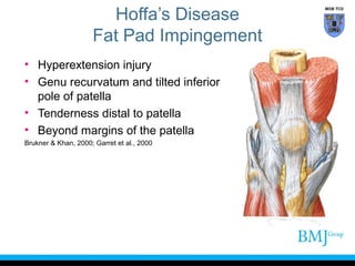 anatomy of Knee | PPT