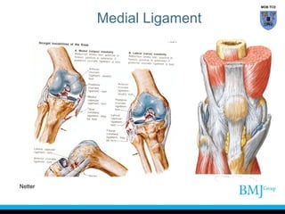Netter Lower Extremity Ligaments Of The Knee Netter