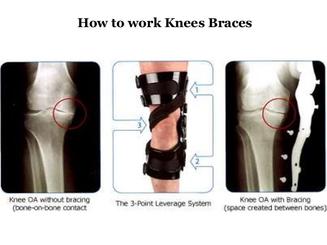 how to make a knee brace what are knee braces how to make a knee brace what are knee braces