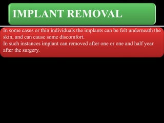 IMPLANT REMOVAL
In some cases or thin individuals the implants can be felt underneath the
skin, and can cause some discomfort.
In such instances implant can removed after one or one and half year
after the surgery.
 