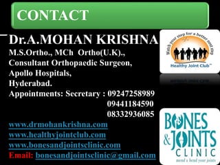 CONTACT
Dr.A.MOHAN KRISHNA
M.S.Ortho., MCh Ortho(U.K).,
Consultant Orthopaedic Surgeon,
Apollo Hospitals,
Hyderabad.
Appointments: Secretary : 09247258989
09441184590
08332936085
www.drmohankrishna.com
www.healthyjointclub.com
www.bonesandjointsclinic.com
Email: bonesandjointsclinic@gmail.com
 