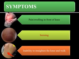 SYMPTOMS
Pain/swelling in front of knee
bruising
Inability to straighten the knee and walk
 