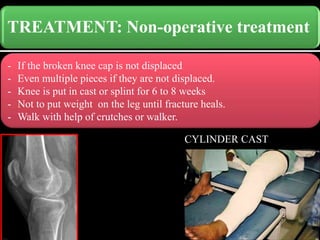 TREATMENT: Non-operative treatment
-
- If the broken knee cap is not displaced
- Even multiple pieces if they are not displaced.
- Knee is put in cast or splint for 6 to 8 weeks
- Not to put weight on the leg until fracture heals.
- Walk with help of crutches or walker.
CYLINDER CAST
 