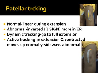 Terminal J Sign Knee clinical examination for orthopaedic residents.dr mohamed ashraf ...