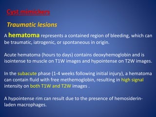 Cyst mimickers
Traumatic lesions
A hematoma represents a contained region of bleeding, which can
be traumatic, iatrogenic, or spontaneous in origin.
Acute hematoma (hours to days) contains deoxyhemoglobin and is
isointense to muscle on T1W images and hypointense on T2W images.
In the subacute phase (1-4 weeks following initial injury), a hematoma
can contain fluid with free methemoglobin, resulting in high signal
intensity on both T1W and T2W images .
A hypointense rim can result due to the presence of hemosiderin-
laden macrophages.
 