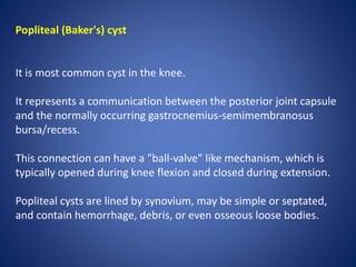 Popliteal (Baker's) cyst
It is most common cyst in the knee.
It represents a communication between the posterior joint capsule
and the normally occurring gastrocnemius-semimembranosus
bursa/recess.
This connection can have a "ball-valve" like mechanism, which is
typically opened during knee flexion and closed during extension.
Popliteal cysts are lined by synovium, may be simple or septated,
and contain hemorrhage, debris, or even osseous loose bodies.
 