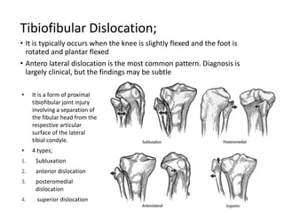 Tibiofibular Dislocation;
• It is typically occurs when the knee is slightly flexed and the foot is
rotated and plantar flexed
• Antero lateral dislocation is the most common pattern. Diagnosis is
largely clinical, but the findings may be subtle
 It is a form of proximal
tibiofibular joint injury
involving a separation of
the fibular head from the
respective articular
surface of the lateral
tibial condyle.
 4 types;
1. Subluxation
2. anterior dislocation
3. posteromedial
dislocation
4. superior dislocation
 