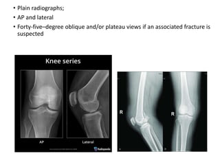 • Plain radiographs;
• AP and lateral
• Forty-five–degree oblique and/or plateau views if an associated fracture is
suspected
 