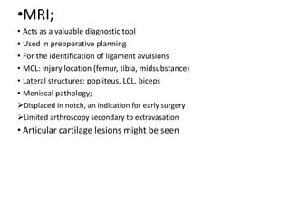 •MRI;
• Acts as a valuable diagnostic tool
• Used in preoperative planning
• For the identification of ligament avulsions
• MCL: injury location (femur, tibia, midsubstance)
• Lateral structures: popliteus, LCL, biceps
• Meniscal pathology;
Displaced in notch, an indication for early surgery
Limited arthroscopy secondary to extravasation
• Articular cartilage lesions might be seen
 