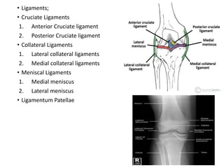 • Ligaments;
• Cruciate Ligaments
1. Anterior Cruciate ligament
2. Posterior Cruciate ligament
• Collateral Ligaments
1. Lateral collateral ligaments
2. Medial collateral ligaments
• Meniscal Ligaments
1. Medial meniscus
2. Lateral meniscus
• Ligamentum Patellae
 