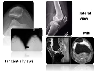 lateral
view
tangential views
MRI
 