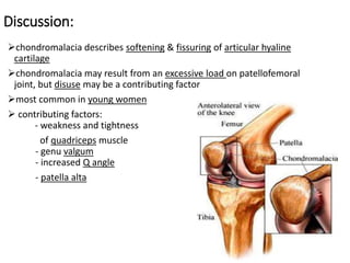 Discussion:
chondromalacia describes softening & fissuring of articular hyaline
cartilage
chondromalacia may result from an excessive load on patellofemoral
joint, but disuse may be a contributing factor
most common in young women
 contributing factors:
- weakness and tightness
of quadriceps muscle
- genu valgum
- increased Q angle
- patella alta
 