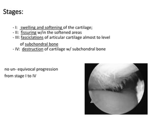 Stages:
- I: swelling and softening of the cartilage;
- II: fissuring w/in the softened areas
- III: fasciclations of articular cartilage almost to level
of subchondral bone
- IV: destruction of cartilage w/ subchondral bone
no un- equivocal progression
from stage I to IV
 