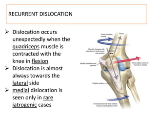 RECURRENT DISLOCATION
 Dislocation occurs
unexpectedly when the
quadriceps muscle is
contracted with the
knee in flexion
 Dislocation is almost
always towards the
lateral side
 medial dislocation is
seen only in rare
iatrogenic cases
 