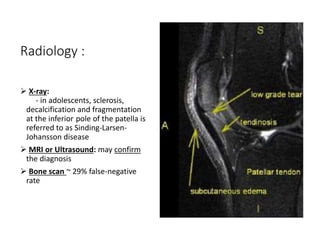 Radiology :
 X-ray:
- in adolescents, sclerosis,
decalcification and fragmentation
at the inferior pole of the patella is
referred to as Sinding-Larsen-
Johansson disease
 MRI or Ultrasound: may confirm
the diagnosis
 Bone scan ~ 29% false-negative
rate
 