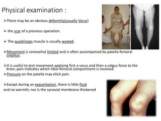 Physical examination :
There may be an obvious deformity(usually Varus)
 the scar of a previous operation.
 The quadriceps muscle is usually wasted.
Movement is somewhat limited and is often accompanied by patella-femoral
crepitus.
It is useful to test movement applying first a varus and then a valgus force to the
knee; pain indicates which tibio-femoral compartment is involved.
Pressure on the patella may elicit pain.
Except during an exacerbation, there is little fluid
and no warmth; nor is the synovial membrane thickened
 