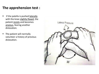 The apprehension test :
 if the patella is pushed laterally
with the knee slightly flexed, the
patient resists and becomes
anxious, fearing another
dislocation.
 The patient will normally
volunteer a history of previous
dislocation.
 