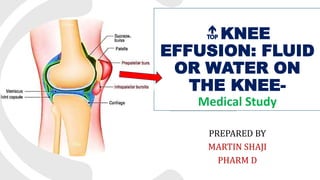 🔝KNEE
EFFUSION: FLUID
OR WATER ON
THE KNEE-
Medical Study
PREPARED BY
MARTIN SHAJI
PHARM D
 
