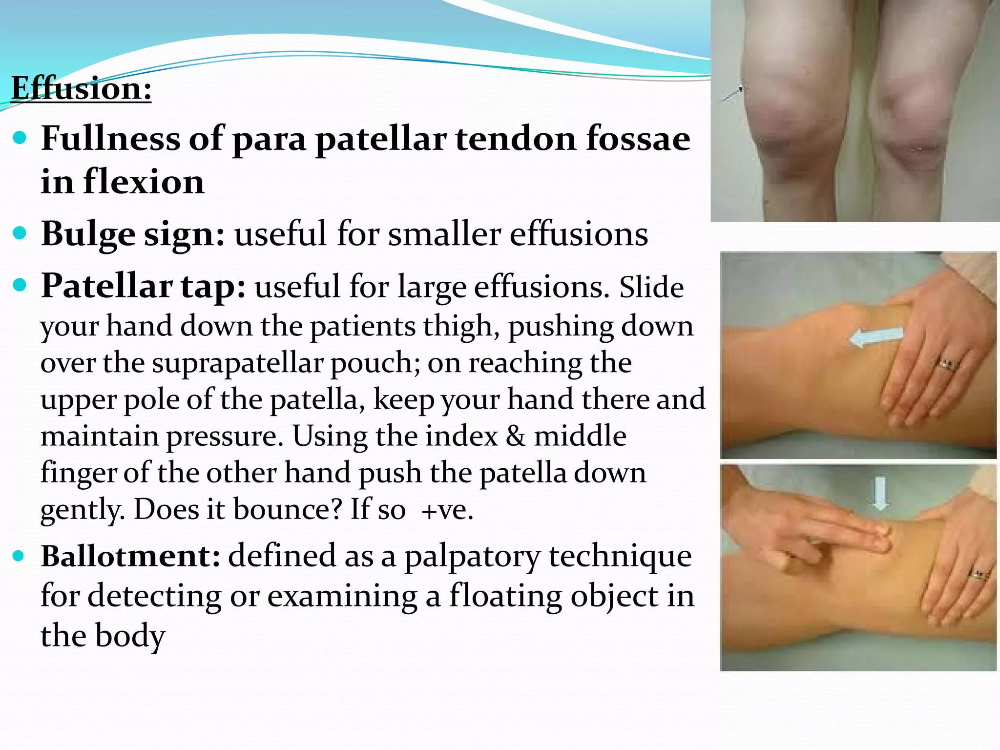Knee Testing Knee examination | PDF