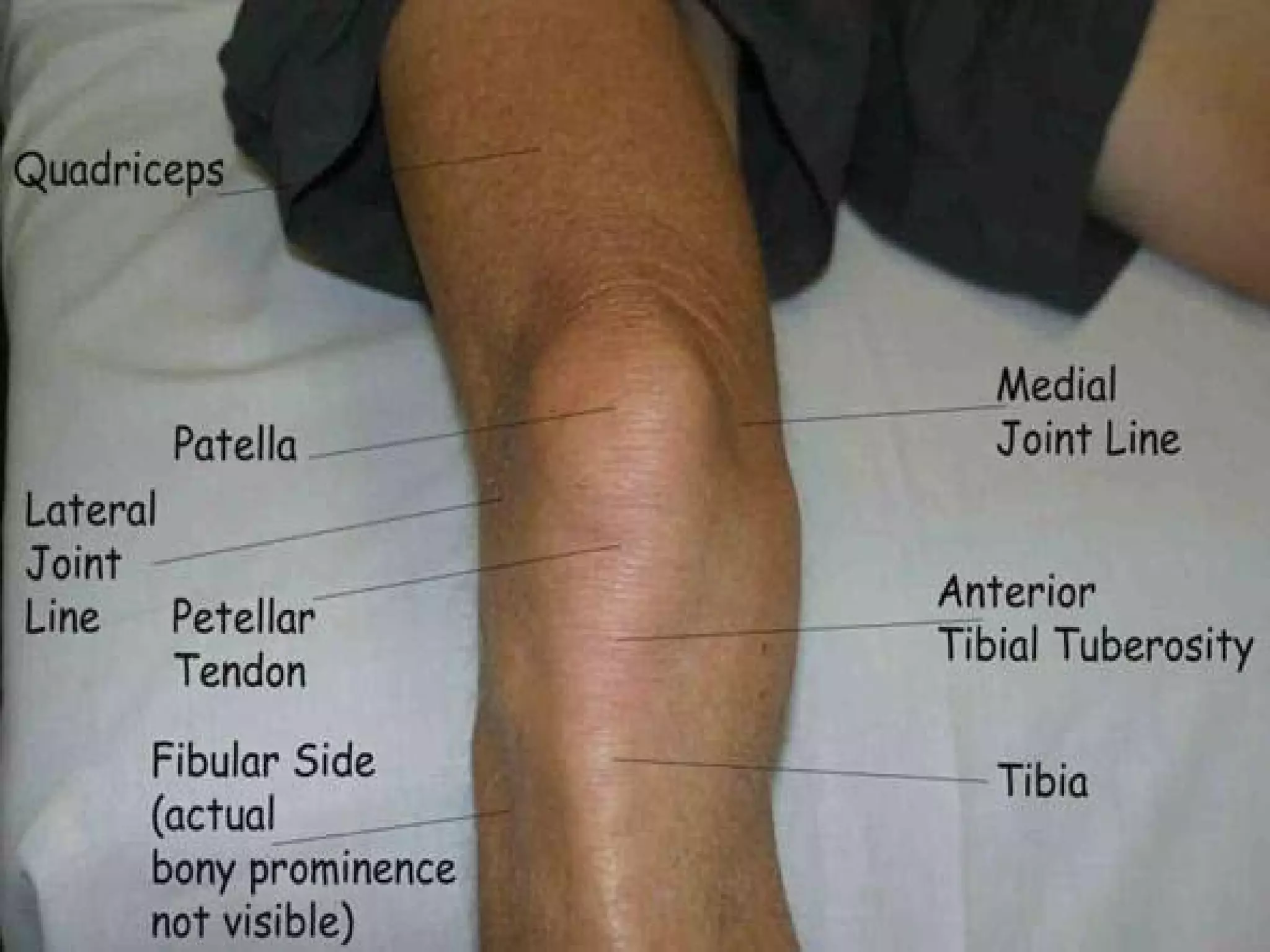 Knee Examination Pdf