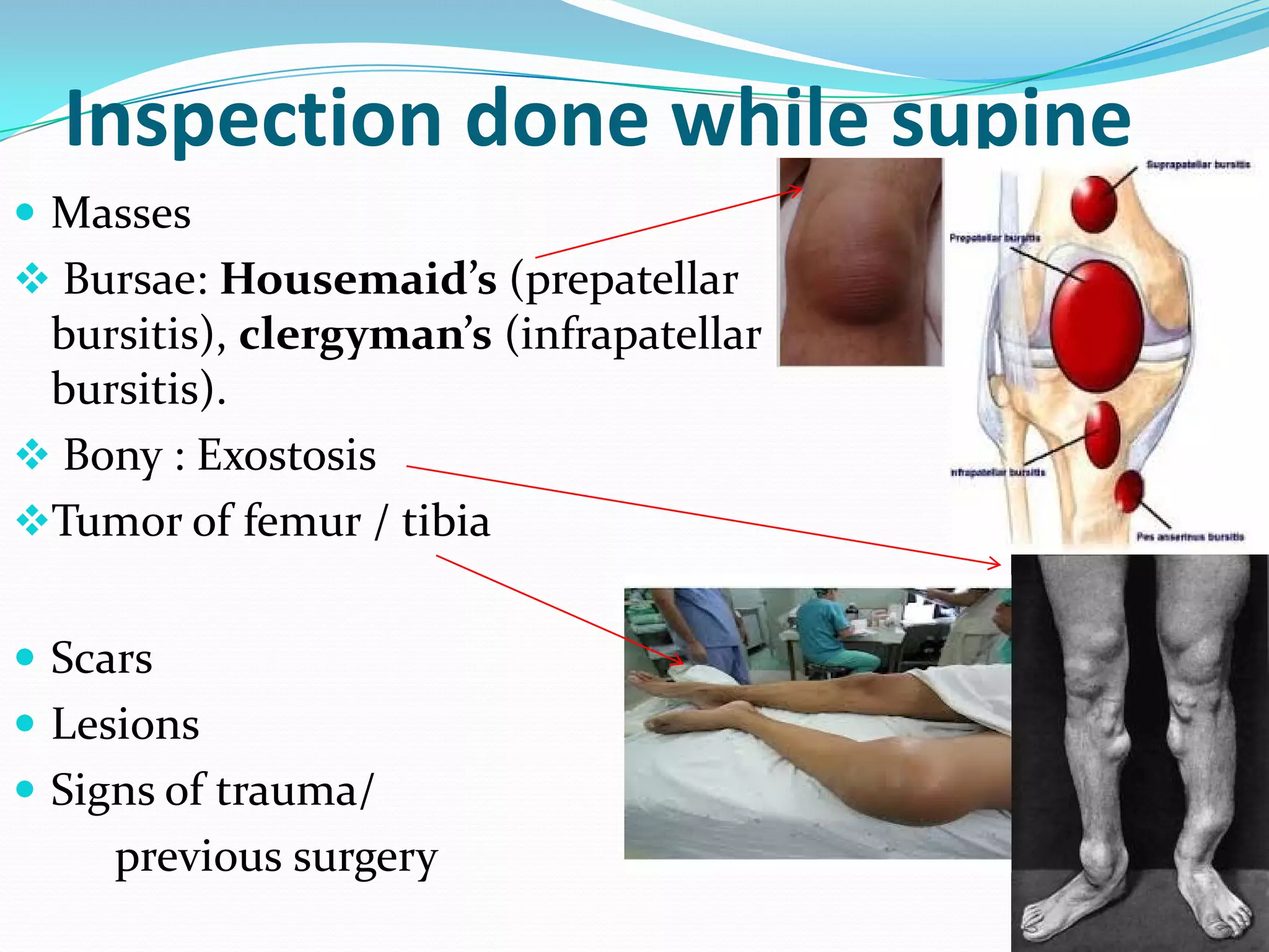 Knee Testing Knee examination | PDF