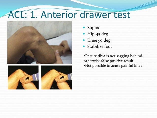 Knee Examination