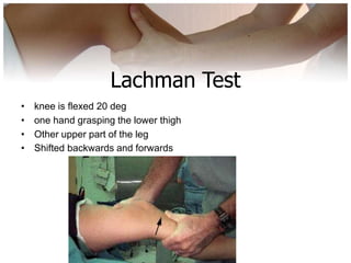 Knee examination | PPTX