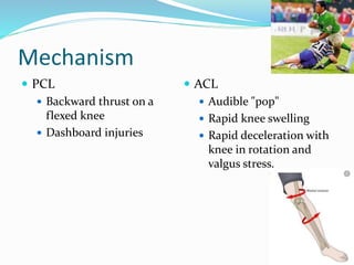 Mechanism
 PCL
 Backward thrust on a
flexed knee
 Dashboard injuries
 ACL
 Audible "pop"
 Rapid knee swelling
 Rapid deceleration with
knee in rotation and
valgus stress.
 
