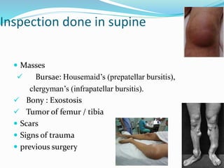 Inspection done in supine
 Masses
 Bursae: Housemaid’s (prepatellar bursitis),
clergyman’s (infrapatellar bursitis).
 Bony : Exostosis
 Tumor of femur / tibia
 Scars
 Signs of trauma
 previous surgery
 