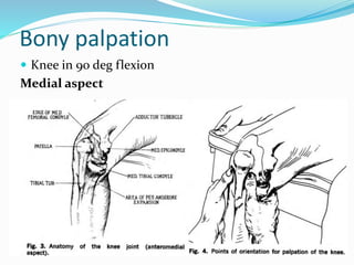 Bony palpation
 Knee in 90 deg flexion
Medial aspect
 