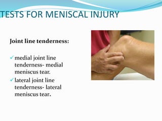 TESTS FOR MENISCAL INJURY
Joint line tenderness:
medial joint line
tenderness- medial
meniscus tear.
lateral joint line
tenderness- lateral
meniscus tear.
 