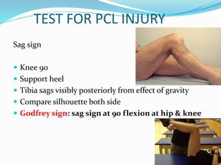 TEST FOR PCL INJURY
Sag sign
 Knee 90
 Support heel
 Tibia sags visibly posteriorly from effect of gravity
 Compare silhouette both side
 Godfrey sign: sag sign at 90 flexion at hip & knee
 