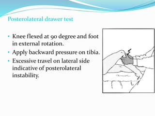 Posterolateral drawer test
• Knee flexed at 90 degree and foot
in external rotation.
• Apply backward pressure on tibia.
• Excessive travel on lateral side
indicative of posterolateral
instability.
 