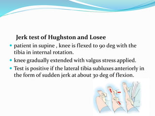 Jerk test of Hughston and Losee
 patient in supine , knee is flexed to 90 deg with the
tibia in internal rotation.
 knee gradually extended with valgus stress applied.
 Test is positive if the lateral tibia subluxes anteriorly in
the form of sudden jerk at about 30 deg of flexion.
 