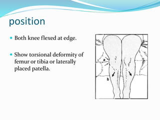 position
 Both knee flexed at edge.
 Show torsional deformity of
femur or tibia or laterally
placed patella.
 