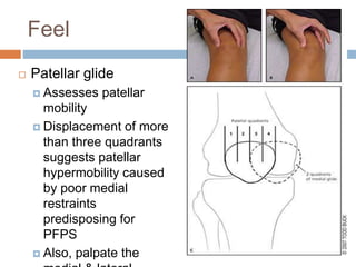 Feel
 Patellar glide
 Assesses patellar
mobility
 Displacement of more
than three quadrants
suggests patellar
hypermobility caused
by poor medial
restraints
predisposing for
PFPS
 Also, palpate the
 