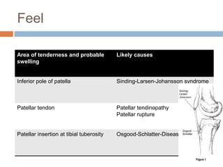 Feel
Area of tenderness and probable
swelling
Likely causes
Inferior pole of patella Sinding-Larsen-Johansson syndrome
Patellar tendon Patellar tendinopathy
Patellar rupture
Patellar insertion at tibial tuberosity Osgood-Schlatter-Disease
 
