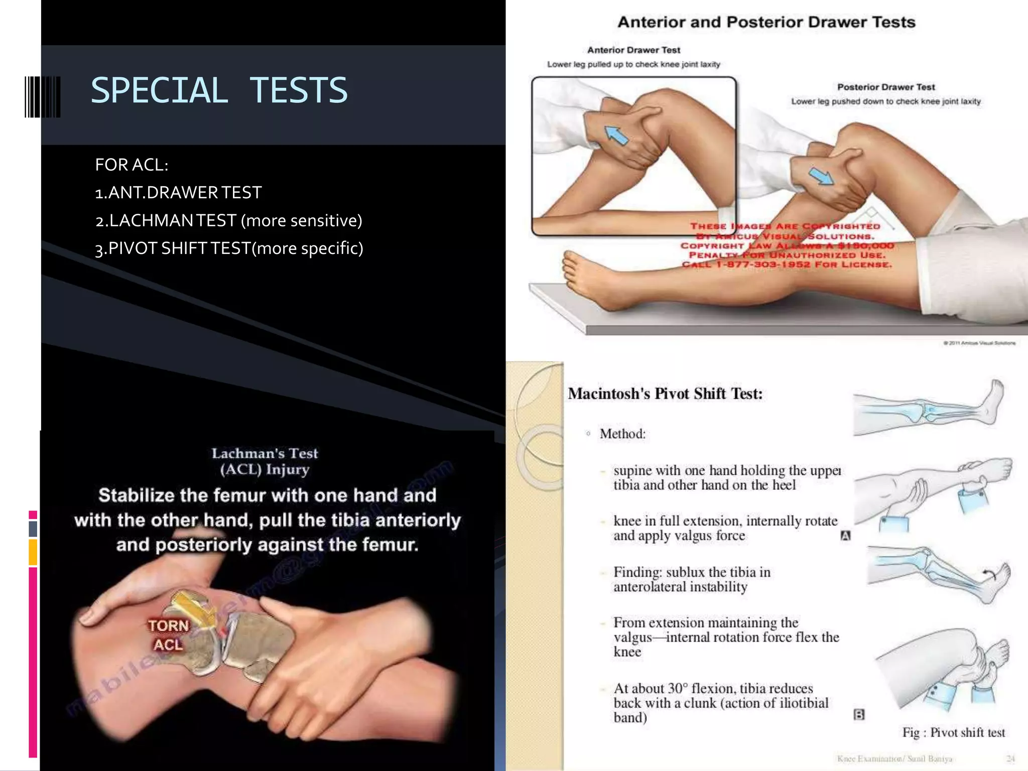 Knee Testing Knee clinical examination by Dr YAGNIK | PPT
