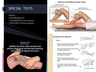 FOR ACL:
1.ANT.DRAWERTEST
2.LACHMANTEST (more sensitive)
3.PIVOT SHIFTTEST(more specific)
SPECIAL TESTS
 